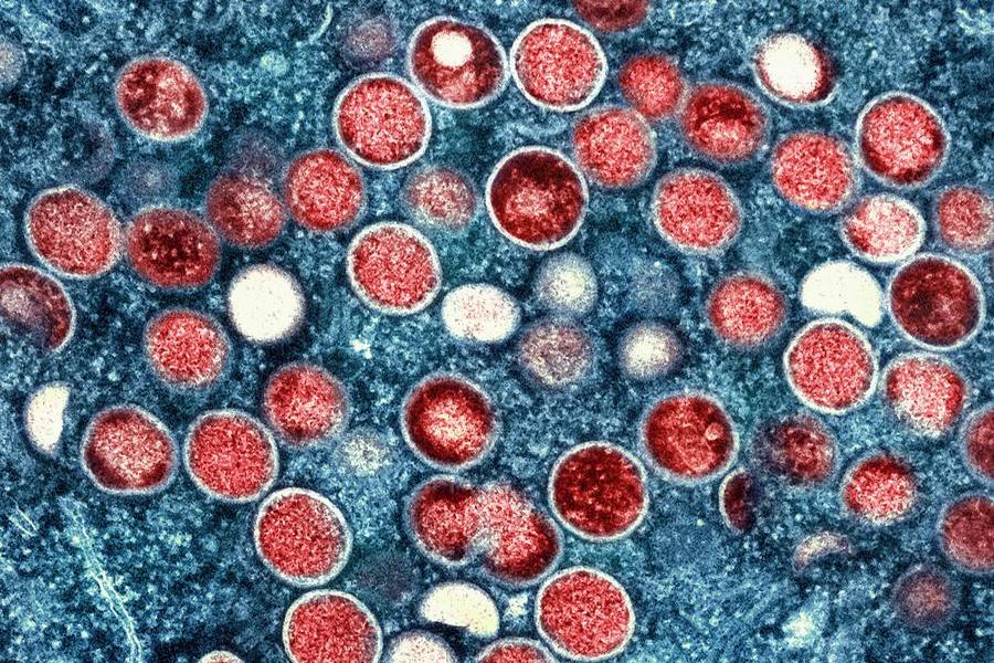 This image provided by the National Institute of Allergy and Infectious Diseases (NIAID) shows a colorized transmission electron micrograph of monkeypox particles (red) found within an infected cell (blue), cultured in the laboratory that was captured and color-enhanced at the NIAID Integrated Research Facility (IRF) in Fort Detrick, Md. The World Health Organization recently declared the expanding monkeypox outbreak a global emergency. It is WHO\\u2019s highest level of alert, but the designation does not necessarily mean a disease is particularly transmissible or lethal. (NIAID via AP)