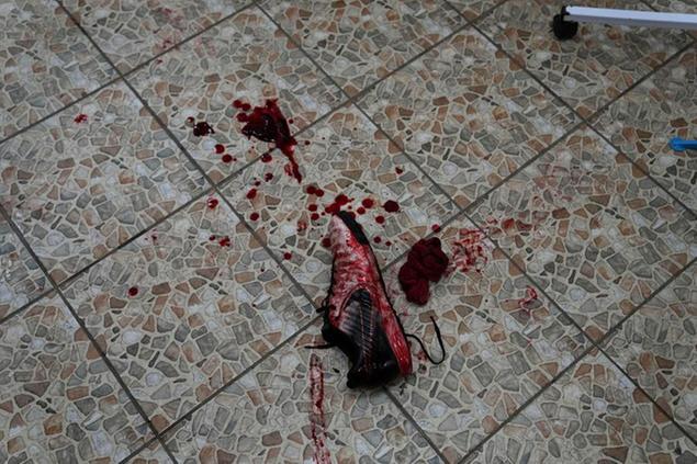 A shoe covered in blood lies on the floor at an emergency surgery in a maternity hospital converted into a medical ward in Mariupol, Ukraine, Wednesday, March 2, 2022. Russian forces have seized a strategic Ukrainian seaport and besieged another. Those moves are part of efforts to cut the country off from its coastline even as Moscow said Thursday it was ready for talks to end the fighting. (AP Photo/Evgeniy Maloletka)