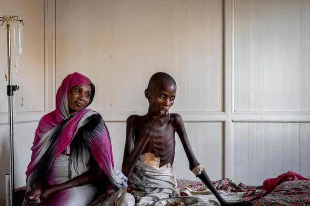 Hassan Adam insieme alla madre Amona Elhadi, all'ospedale Al Nau di Omdurman in Sudan (foto di Ivor Prickett)