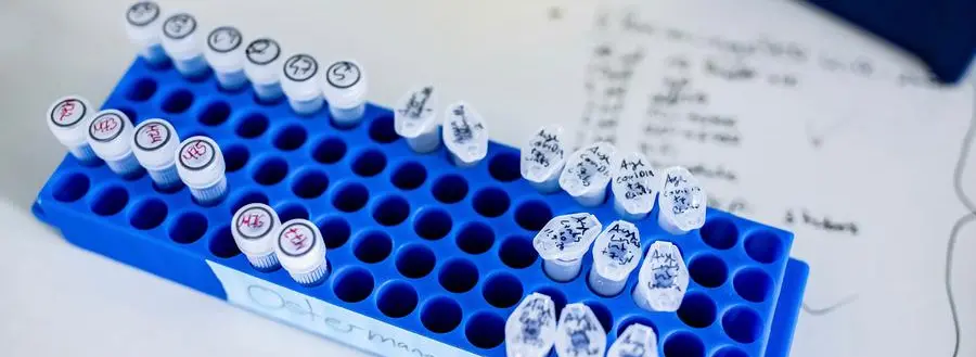 20 May 2020, North Rhine-Westphalia, Duesseldorf: Samples for coronavirus research are placed on a table in the laboratory of the Heinrich Heine University in D'sseldorf. The research projects include immunity after cured infection and research data on the effectiveness and significance of Remdesivir in clinical application. Photo by: Marcel Kusch/picture-alliance/dpa/AP Images